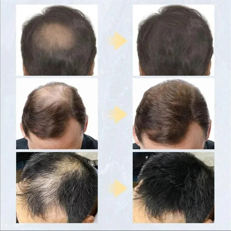 Natural Queratina Hair Styling Pó - Volume e Densidade Instantâneos!